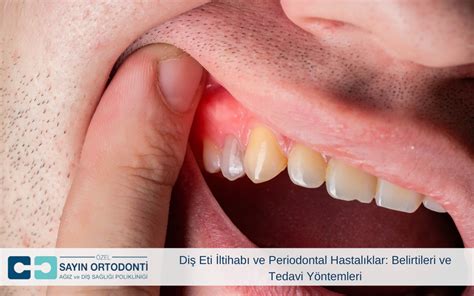 Diyabet ve periodontal hastalık için diş protezleri
